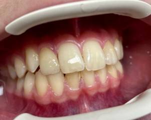 Cyril Normand - Prothésiste Dentaire (11)