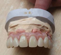 Cyril Normand - Prothésiste Dentaire (9)