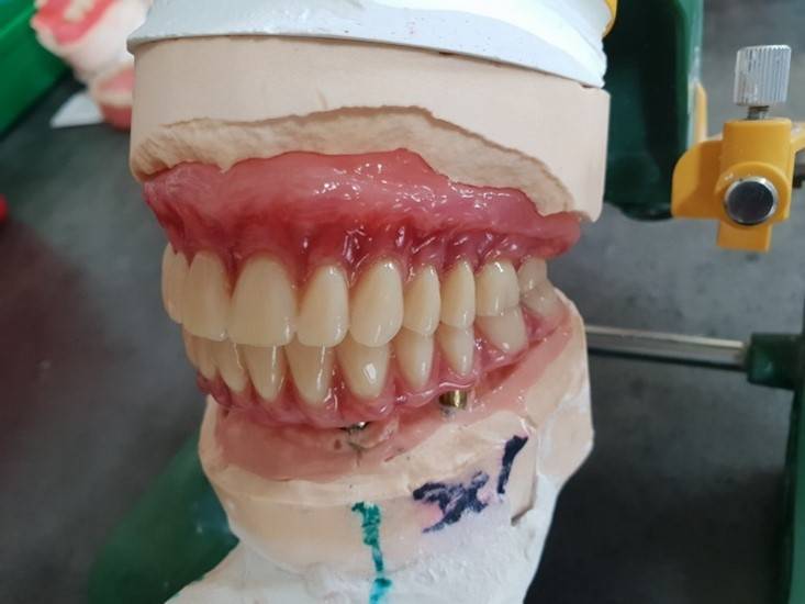 Cyril Normand - Prothésiste Dentaire (8)