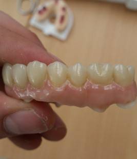 Cyril Normand - Prothésiste Dentaire (6)