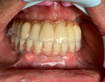 Cyril Normand - Prothésiste Dentaire (2)